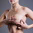 mastectomy reconstruction