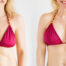 Replacing Breast Implants