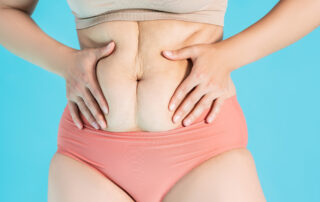 abdominoplasty vs tummy tuck