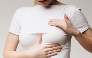 Nipple-Sparing Mastectomy